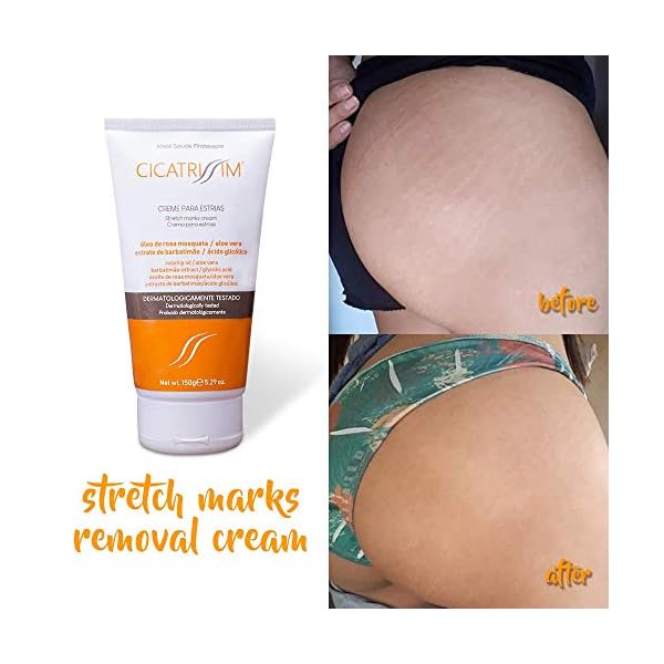 Cicatrissim Stretch Marks Removal Cream - Innovative Natural Formula With Pure and Potent Ingredients From Brazilian…