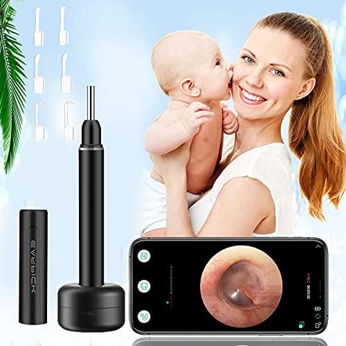 Topicy Ear Wax Removal Tool, 1080P FHD Ear Wax Remover Endoscope with