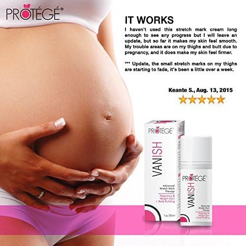wanish skin lotion for stretch marks
