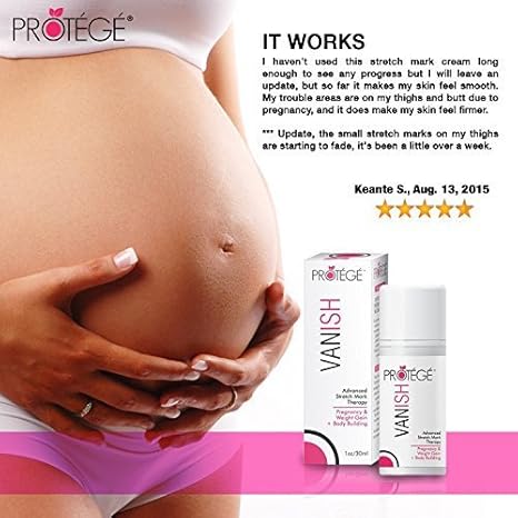wanish lotion for stretch marks