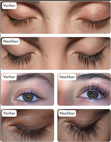 Toplash XL Eyelash and Eyebrow Booster - Growth Serum with Eyelash and Eyebrow Enhancer - Promotes Healthy, Strong Eyelashes - with Natural Potanicals and Peptides - 6 ml