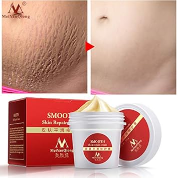 body shop products for stretch marks