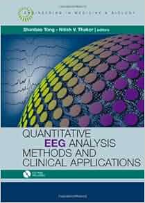 Quantitative Eeg Analysis Methods And Applications With
