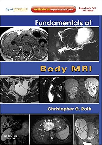 Fundamentals Of Body Mri Expert Consult Online And Print Fundamentals Of Radiology 9781416051831 Medicine Health Science Books Amazon Com