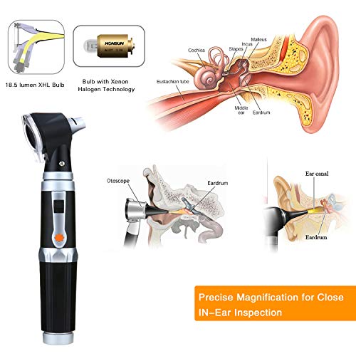 Otoscope Kit,Professional Diagnostic Ear Care Tool with 2.5V Halogen
