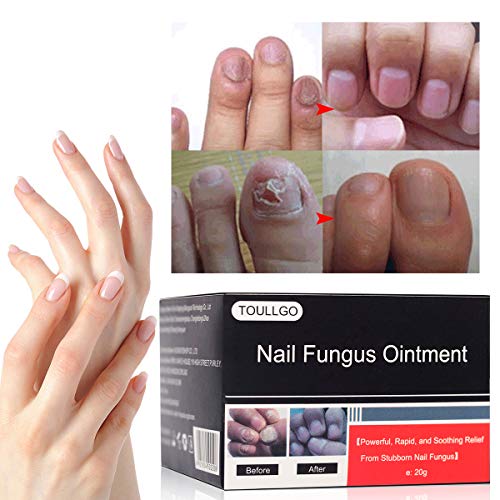 Nail Repair Solution, Nail Treatment, Onychomycosis Treatment, Onychomycosis Cream, Fingernails Repair, Effective Personal Care Supply, 20g