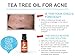 Tea Tree Oil by AromaOils - Pure Therapeutic Grade Melaleuca Oil - 1 fl oz (30 ml) - Best for Skin Tag Removal, Nail Fungus Treatment, Aromatherapy, Scented Massage Oil, Acne Reducer, Facial Toner (Package may vary)