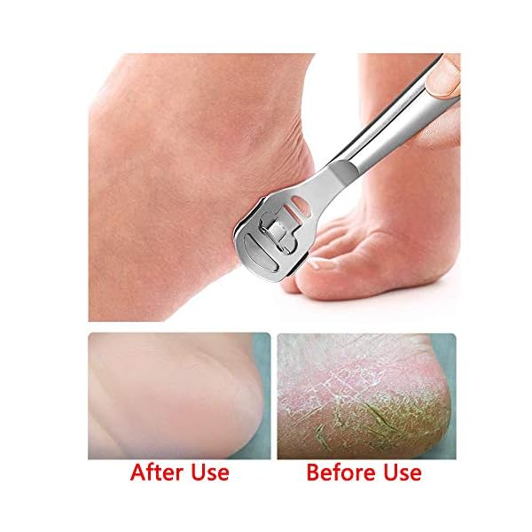 2-Pcs-Scraper-Foot-File-Pedicure-Callus-ShaverFoot-Hand-Care-Skin-Remover-File-for-Women-and-Men 2 Pcs Scraper Foot File Pedicure Callus Shaver,Foot Hand Care Skin Remover File for Women and Men