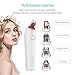 Blackhead Remover, Xpreen Pore Vacuum Rechargeable Pore Cleaner with 4 Multi-Functional Probe, Blackhead Vacuum Especially for Acne,Fett & Facial Pore Clean (White)