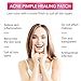Haphome Pimple Patch, Acne Patch, Tea Tree and Calendula Oil Hydrocolloid Bandages for Acne Dots, Acne Spot Treatment Zit Patch (144 Patches, 4 Pack)
