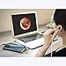 Digital Ear Scope,ScopeAround 2 in 1 USB Otoscope Ear Inspection Camera for Android, PC & Mac with 6 LED Adjustable Lights, 5.9ft