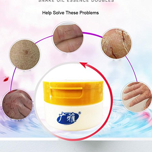 DZT1968 1pc/140g Antifreeze Crack Skin Care Cream Moisturizing Body Crack skin chapped Protection