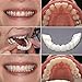 Temporary Smile Comfort Fit Cosmetic Teeth, Vovomay Denture Teeth Top Cosmetic,Fit at Home Do it Yourself Smile Makeover!