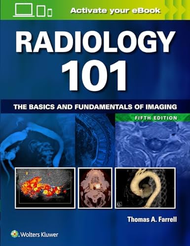 Amazon.com: Medical Imaging Signals and Systems: 9780132145183