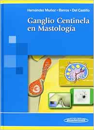 Ganglio centinela en Mastología