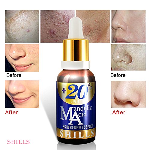 SHILLS Anti Acne & Scars Face Serum 20 Mandelic Acid & Vitamin E For
