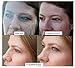 Lifting & Firming Serum 91% Organic DMAE MSM Caffeine Peptides Proven Results! Oil Free VEGAN pH Balanced