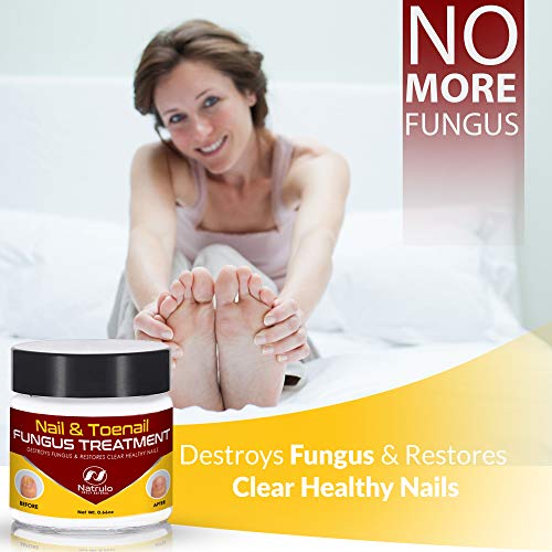 image for Natrulo Nail & Toenail Fungus Treatment - Herbal Anti Fungal Cream wit
