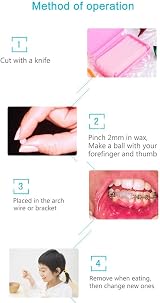 RZJZGZ Dental Wax for Braces - 6 Boxes, Fruit Smell, Gum Protection view 4