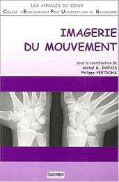 Imagerie du mouvement