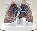 COPD Lung Anatomical Classroom Education Model CEM