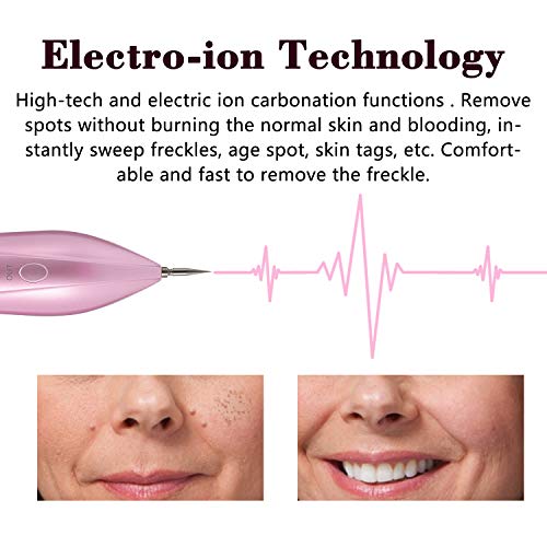 Yansu Skin Tag Portable Skin Care 10-Level Adjustable Eraser with LCD