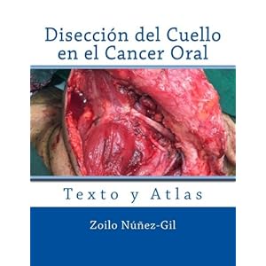 Diseccion del Cuello en el Cancer Oral (Spanish Edition)