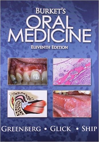 burkets oral medicine 11th edition