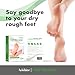 Arishine Foot Peel Mask, Exfoliating Foot Mask, Peels Away Calluses and Dead Skin