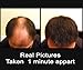 Samson Hair Fiber Refill 100 Grams For Hair Loss Concealing USA Suitable for all brands (Dark Brown)