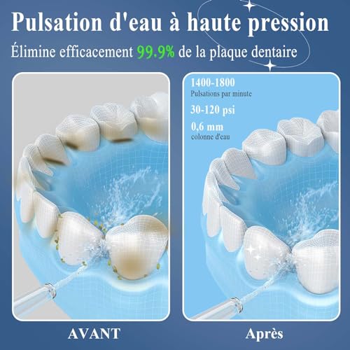 SURFOU Professional Dental Jet Water Flosser for Teeth, Irrigators and Irrigators Cleaning Teeth Water Jet, Tooth Cleaner Pulser Interdental Irrigator Portable Scaler