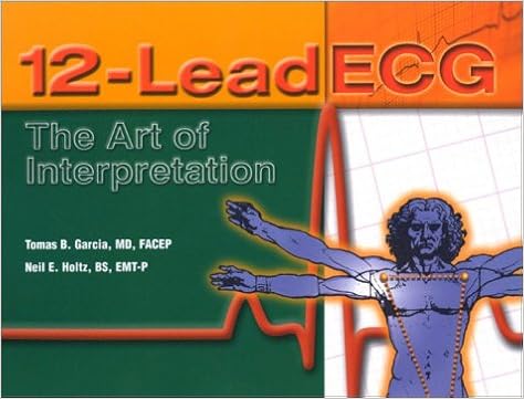 12 Lead Ecg The Art Of Interpretation Garcia Tomas 9780763712846 Amazon Com Books