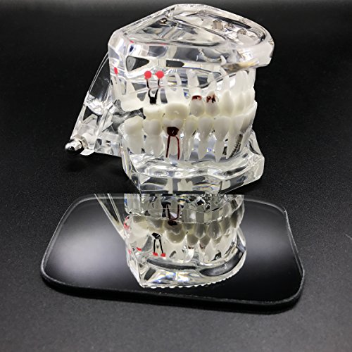 Omonic 5Pcs/Set 2 Sided Pofessional Dental Occlusal Photographic Mouth Mirror Rhodium Dental Plated Glass Intraoral Photo Reflector - Thumbnail 6