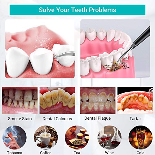 Ultrasonic Teeth Cleaner for Teeth, NICARE Plaque Remover Dental