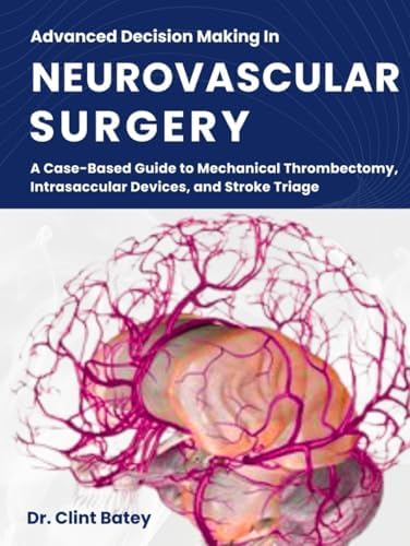 Decision Making in Neurovascular Disease: 9781684200573: Medicine