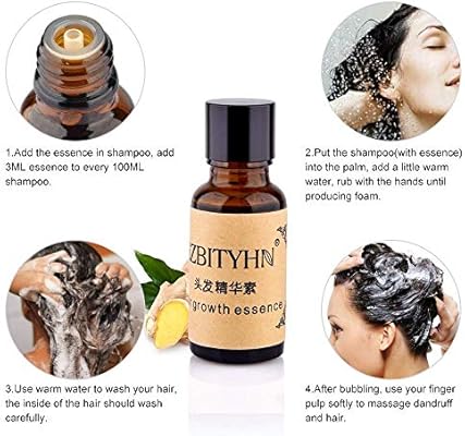 Amazon Com Hair Growth Essence Stcorps7 Hair Loss Liquid Dense