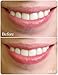 Pilaten Lip Gel Mask Moisture Essence Lip Care Pads Crystal Collagen Patch Gel Pad (20pcs)