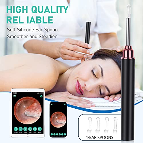 Ear Wax Removal Tool,Ear Cleaner Camera with 10 Pcs Ear Set,1080P HD Smart Rechargable,Ear Otoscope with 6 LED Lights Ear Cleaning Kit,Compatible with iPhone, Andriod Phones and Tablets(Black)