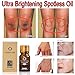 2 PACK Ultra Brightening Spotless Oil Skin Care Natural Pure Dark Spots Remove Ance Burn Strentch Marks Scar Removal Brightening Skin Essence 10ML