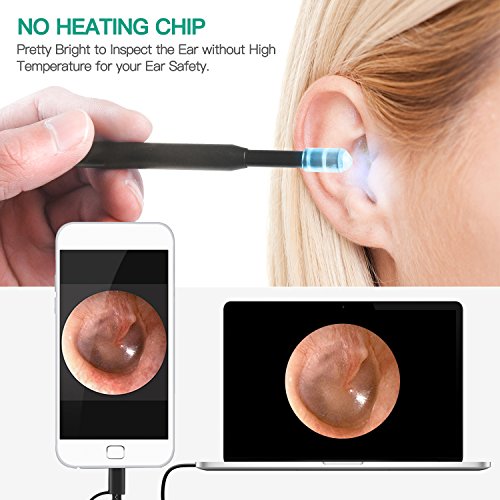 TryAce USB Otoscope Camera, Digital Ear Scope Ear Inspection Camera with 6 LED Lights for Micro USB & USB-C Android Devices, Windows & MAC PC Computer-Black