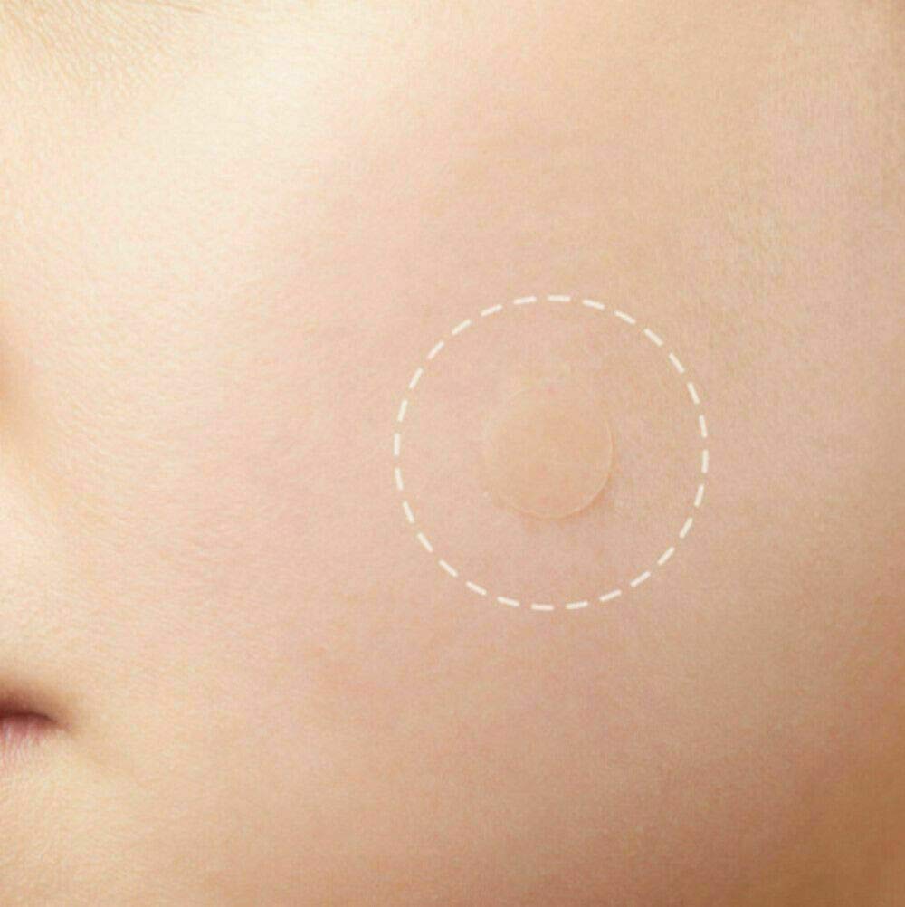 Acne Pimple Remover Patch and Skin Tag(72Dots) Acne Patches Absorbing Cover Skin Tag Hydrocolloid for Skin Two Universal Sizes Invisible Acne Patches For Face Blends in with Skin: Beauty
