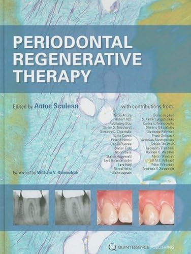 Download Periodontal Regenerative Therapy PDF