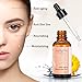 LuckyFine Retinol 2.5 Serum | Retinol Serum with Hyaluronic Acid + Vitamin C,Best Treatment for Acne and Acne Scars, Pigmentation, Fine Lines, Wrinkles and Dark Circles - 30ml (1 fl.oz)