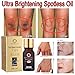 Ultra Brightening Spotless Oil,Wishwin Skin Care Natural Pure Remove Ance Pure Nature Essential Oil Dark Spots Removal Age Spots Hyper-Pigmentation Brightening Skin Essence