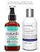 Dry Scalp Treatment, For Psoriasis, Eczema, Itchy And Flaky Scalp - StratumRX Psoriasis Treatment Serum And Itchy Scalp Treatment - Big 4 OZ Size!