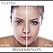 PowMax Blackhead Remover Rechargeable Electronic Acne Remover Facial Pore Cleaner Utilizes Pore Vacuum Extraction