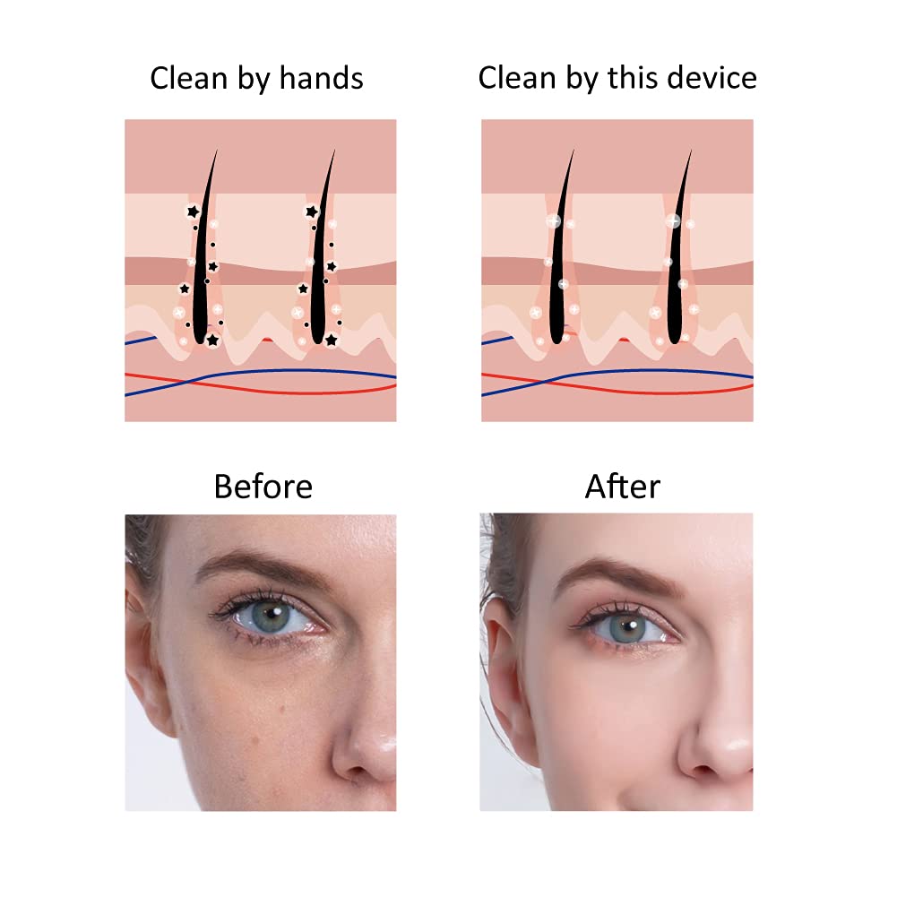 Wrinkle Reduction Machine, Skin Tightening Facial Massager Anti-aging face neck massager handheld skin lifting device with charging base and USB cable, 5 modes and 5 gears: Beauty