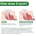 Anti Snoring Stop Snore Nose Vents Sleep Aid Device for Natural and Comfortable Sleep, Instant, Fast and Safe Snore Relief / Set of 4 and Travel Case