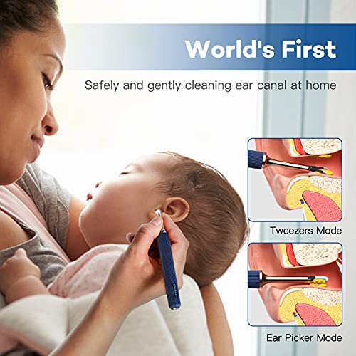 BEBIRD Note3 Pro Max,Ultimate Version,10 Megapixel HD,Allin1 Ear Wax