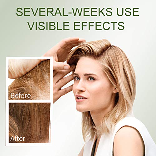 Hair Growth Oil, Hair Oil for Men, Alopecia Areata Treatment, Stops Hair Loss, For Thinning Hair, Alopecia Areata, Promotes Thicker, Fuller ＆ Faster Growing - Thumbnail 3